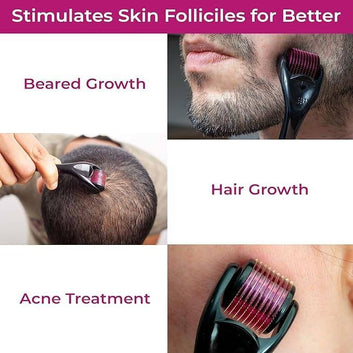 Derma Roller System – Boost Hair Growth & Restore Confidence 🌿